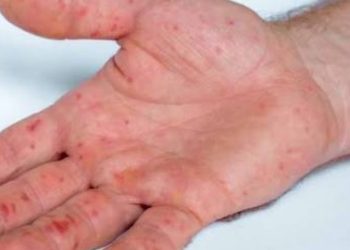 Investigan ataque a patrulla en inmediaciones de El Trompillo