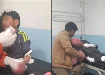 Niño de 9 años pierde cinco dedos por explosión de petardo en bloqueos de El Alto