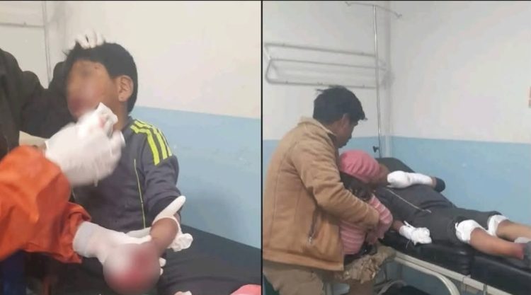 Niño de 9 años pierde cinco dedos por explosión de petardo en bloqueos de El Alto